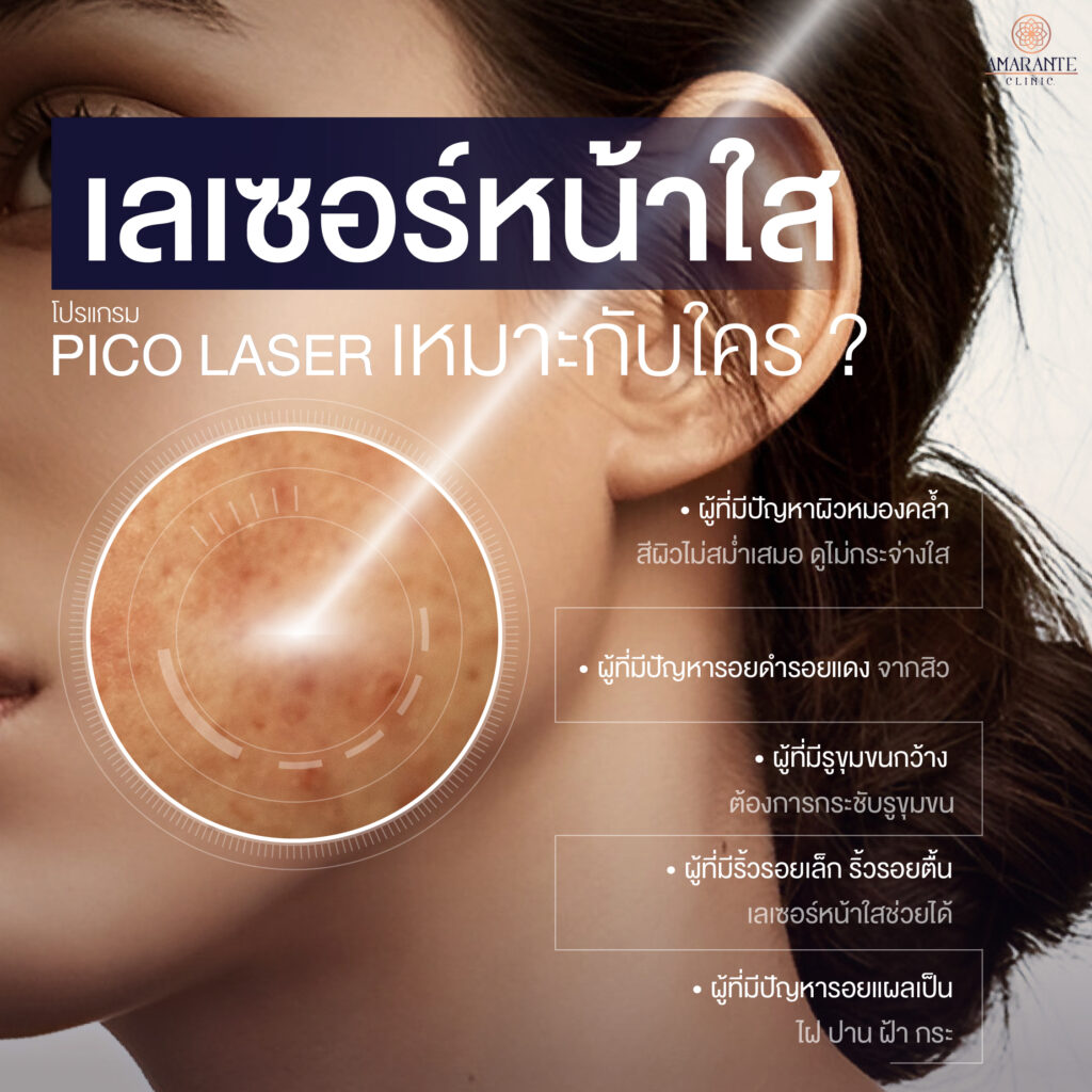 ภาพ infographic อธิบายใครเหมาะกับการทำเลเซอร์หน้าใส