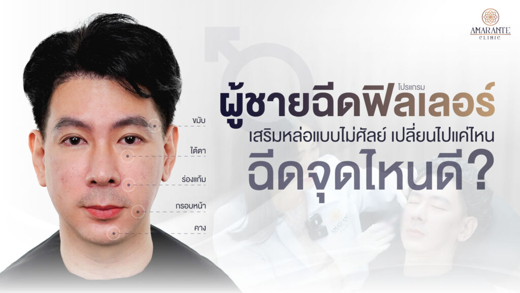 ปกภาพของบทความ ผู้ชายฉีดฟิลเลอร์ เสริมหล่อแบบไม่ศัล เปลี่ยนไปแค่ไหน ฉีดจุดไหนดี?
